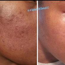 Load image into Gallery viewer, Ray Of Sunshine (Skin Care Unisex)