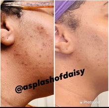 Load image into Gallery viewer, Ray Of Sunshine (Skin Care Unisex)